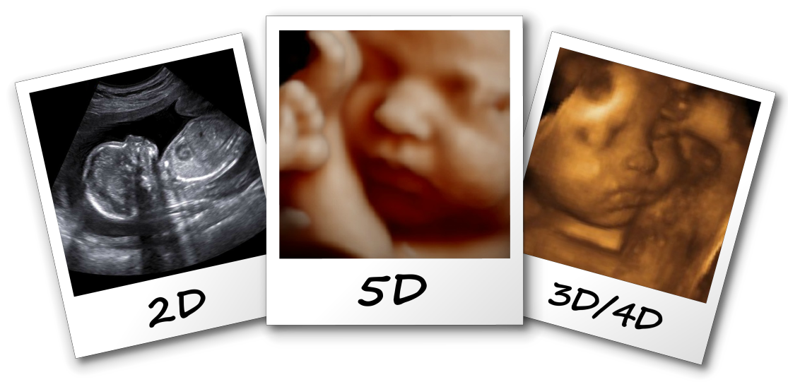 5D ultrazvuk